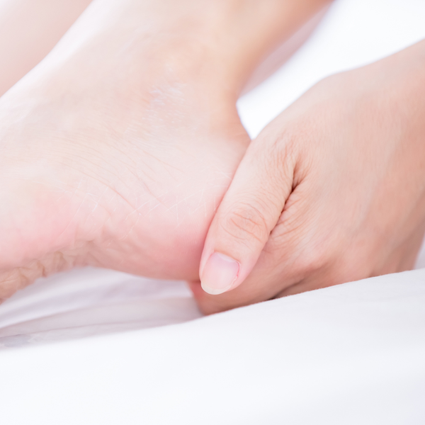 Kowa 20% Urea Cream Hand and Foot Cream for Dry Skin 60g